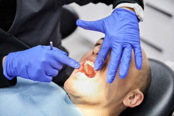 Best Emergency Gum Treatment in New Rockford, ND